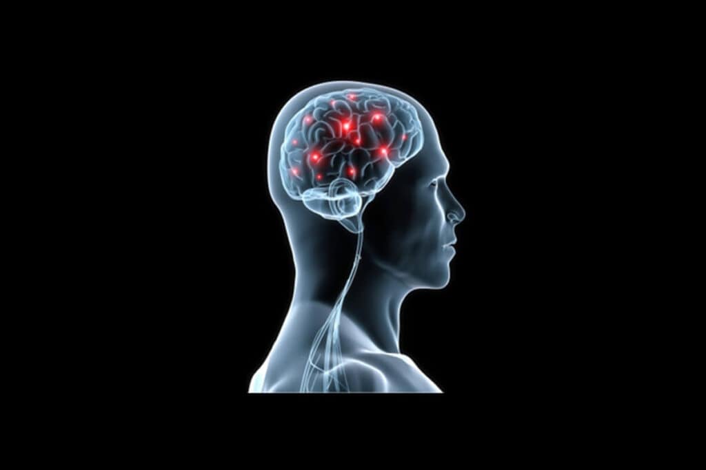 Vad är det för skillnad på hjärtinfarkt, stroke och hjärtstopp?